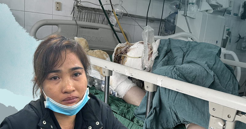 Chồng nguy kịch vì bỏng, con mắc bệnh di truyền: Vợ nghèo kiệt quệ cầu cứu