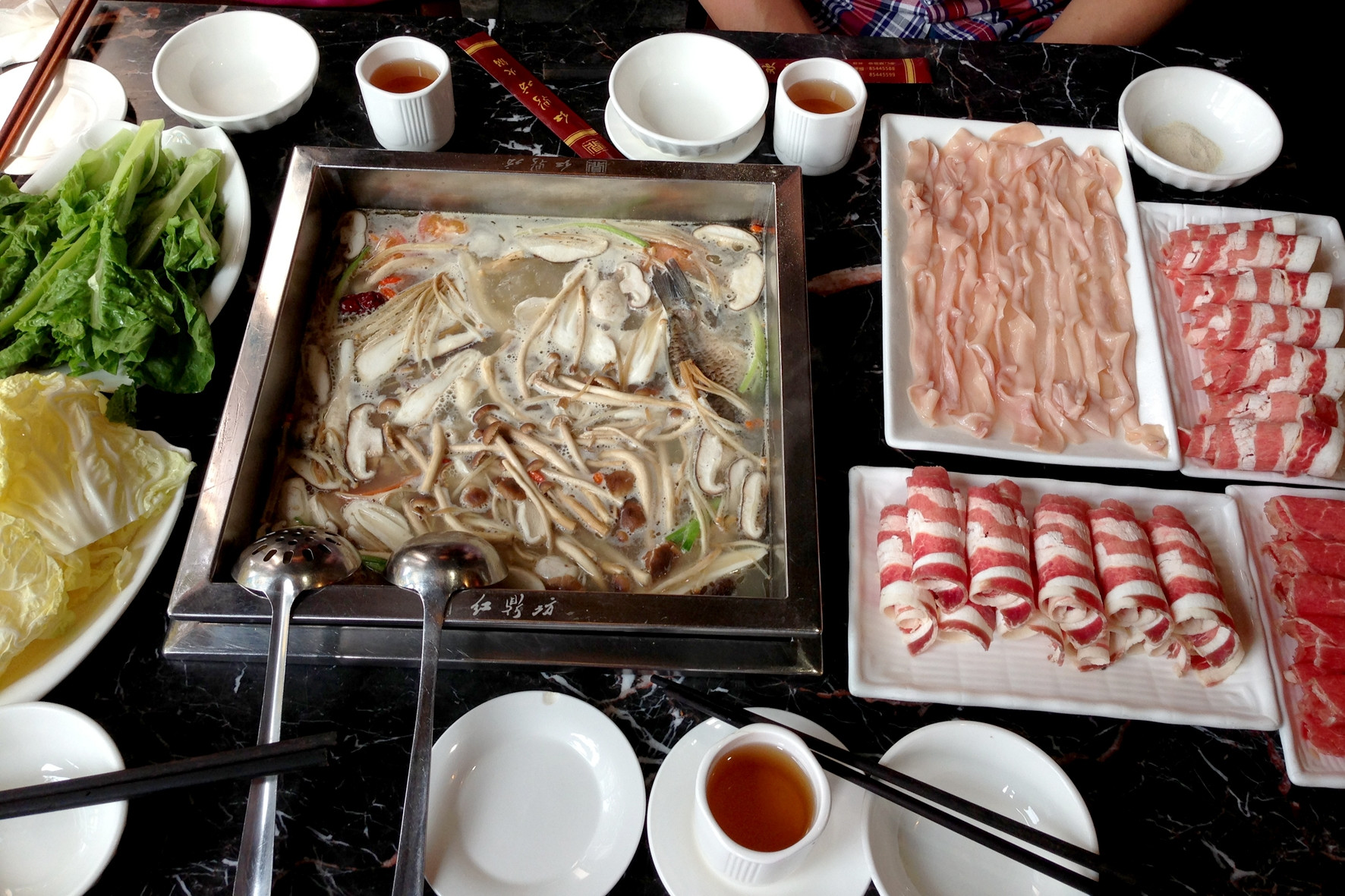 Ăn lẩu cay liên tiếp 3 ngày, người phụ nữ phải đi cấp cứu, phẫu thuật khẩn