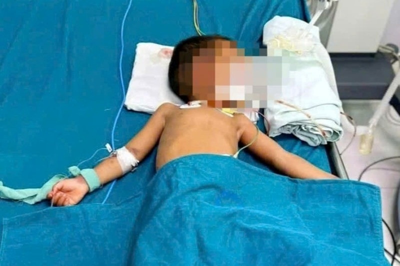 Bé trai 4 tuổi nguy kịch vì bị rắn lục đuôi đỏ cắn
