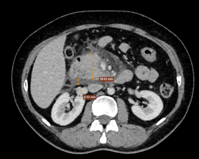 1 chup msct medlatec.jpg
