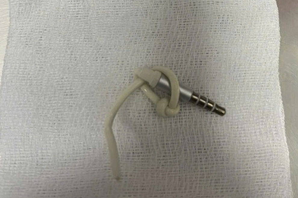 Ca cấp cứu hi hữu: Jack cắm kèm dây cáp tai nghe trong vùng kín nam thanh niên