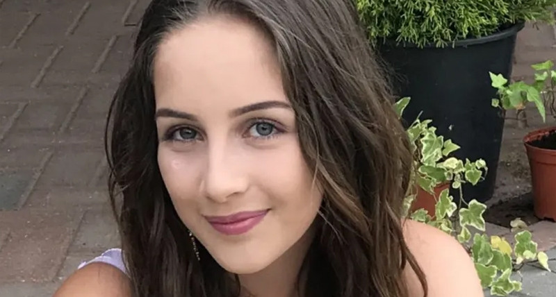 Căn bệnh lạ khiến cô gái bỏng mặt khi cười