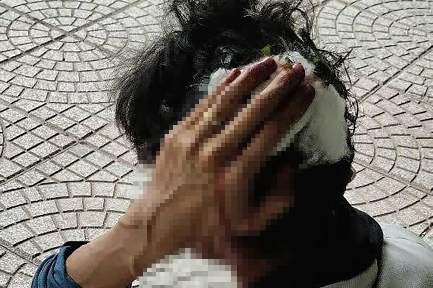 Xác minh vụ nam shipper bị 2 vợ chồng hành hung, phải nhập viện cấp cứu