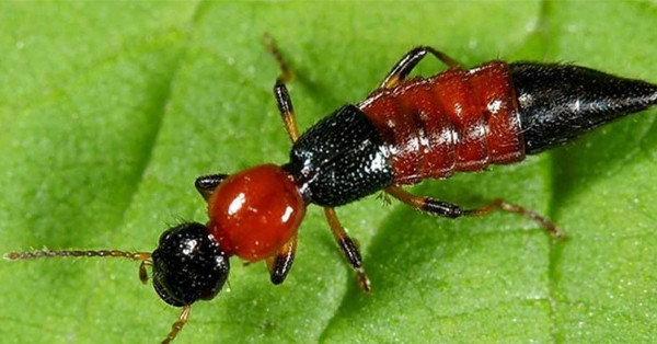 Toàn thân biến dạng, vùng kín tổn thương vì đắp dịch kiến ba khoang chữa ngứa