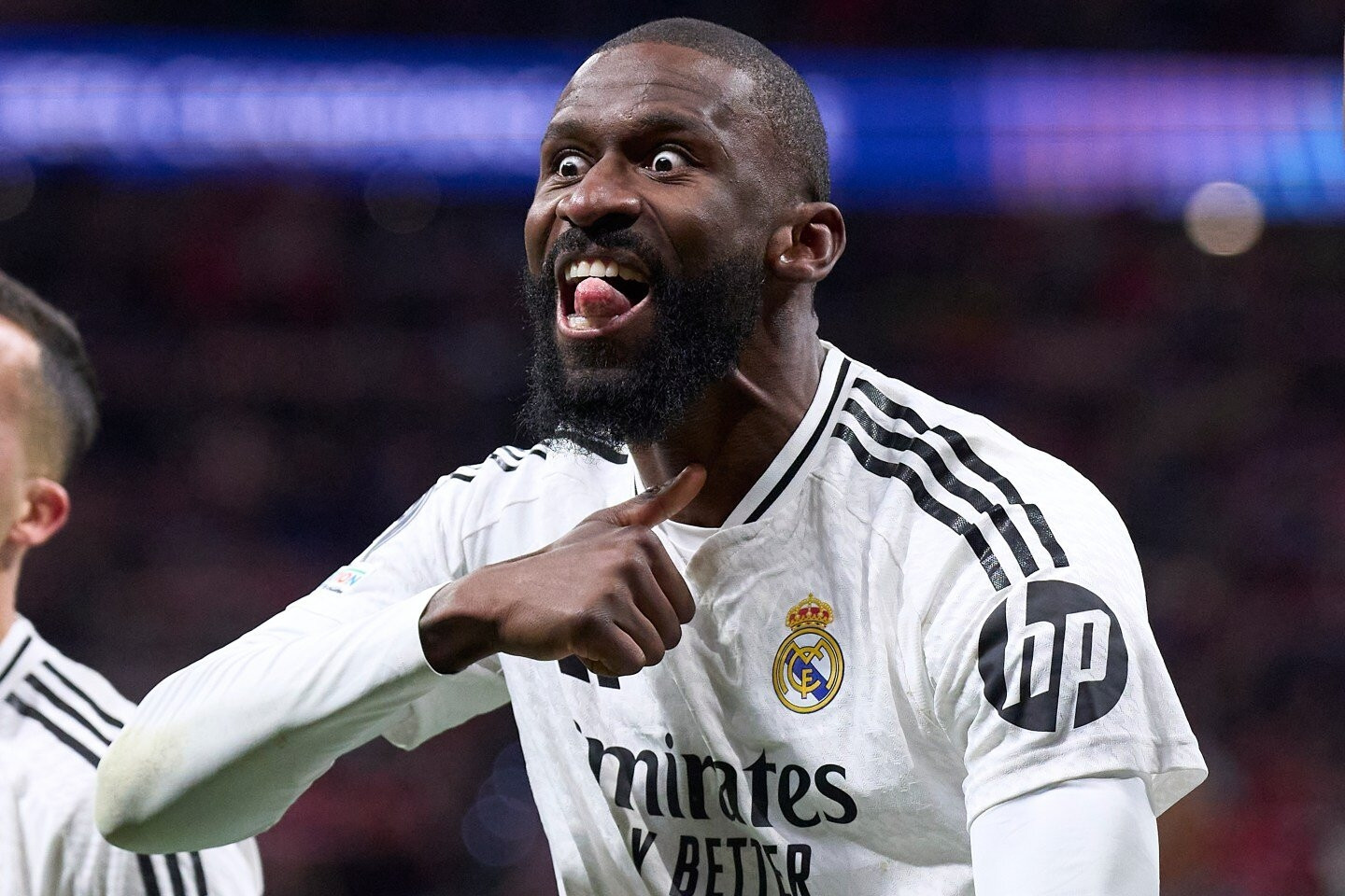 Real Madrid gặp biến lớn ở Champions League