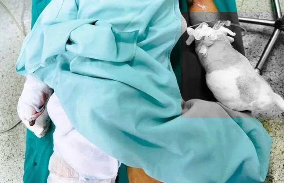 Học sinh lớp 6 nát bàn tay do chế tạo pháo