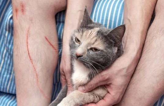 Người đàn ông trẻ tử vong sau 3 tháng bị mèo cào vào bắp chân