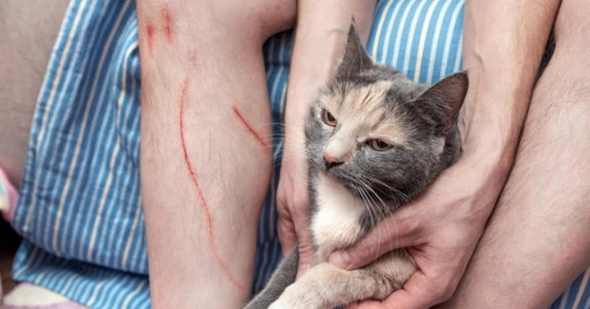 Người đàn ông trẻ tử vong sau 3 tháng bị mèo cào vào bắp chân