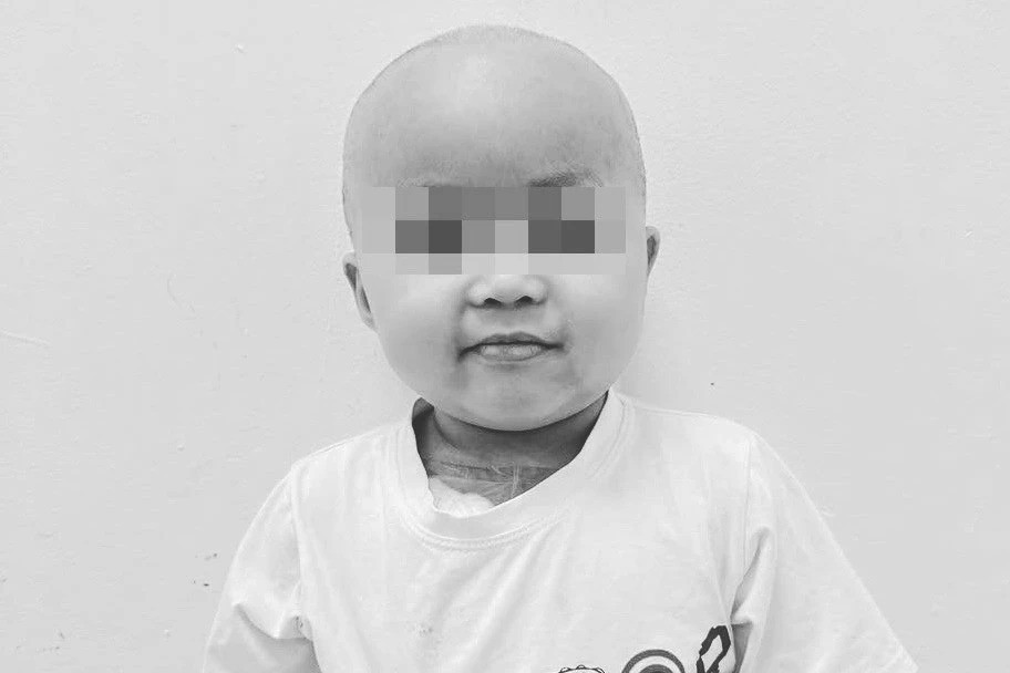 Bản tin trưa 18/4: Bé Bắp qua đời