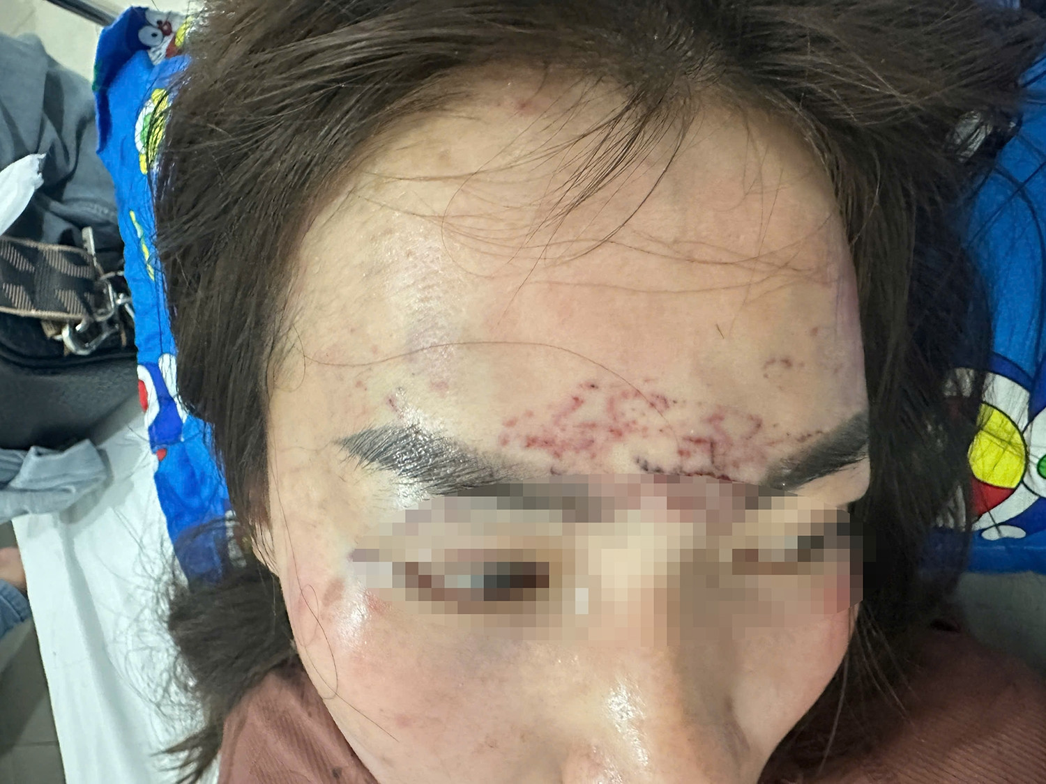 Người phụ nữ đi đường bất ngờ bị kéo lên ô tô, ‘tra tấn’ bằng axit và máy xăm