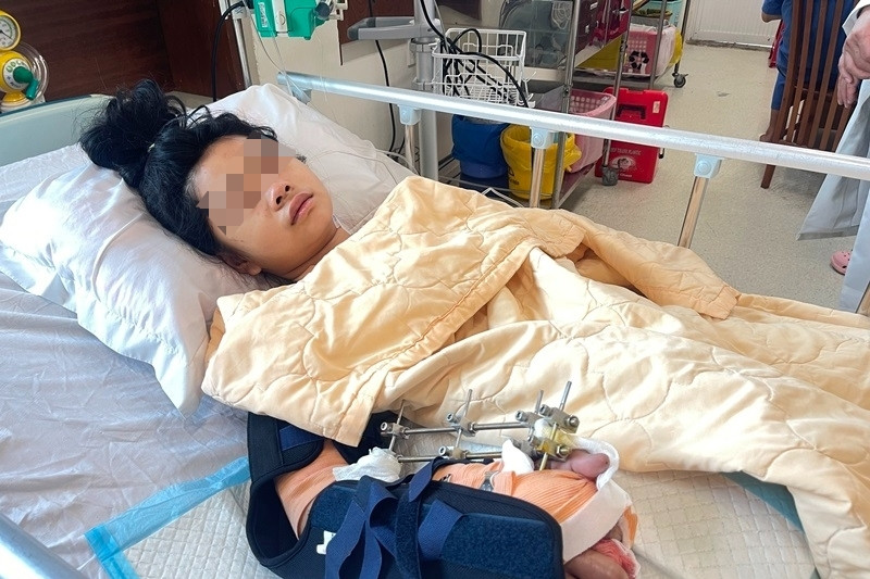 Ca mổ xuyên trưa cứu bàn tay của nữ sinh vụ lật xe khiến 21 người cấp cứu