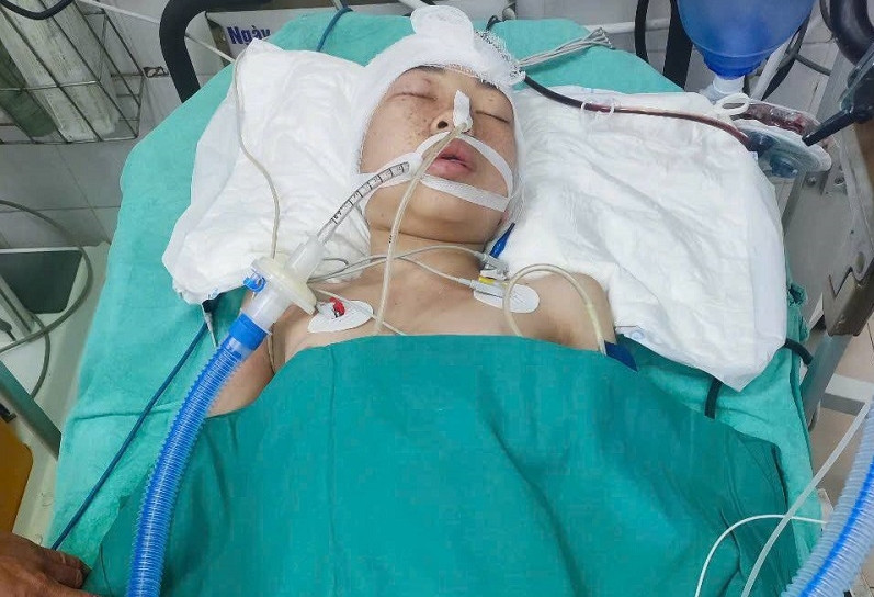 Con gái động kinh ngã chấn thương sọ não, mẹ nghèo cạn tiền không biết vay ai