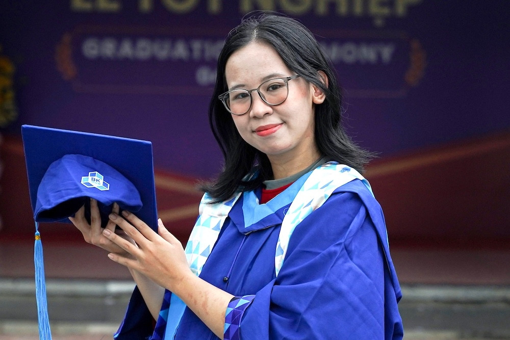Gần 20 năm sống với 1 quả thận, nữ sinh tốt nghiệp xuất sắc ĐH Bách khoa TPHCM