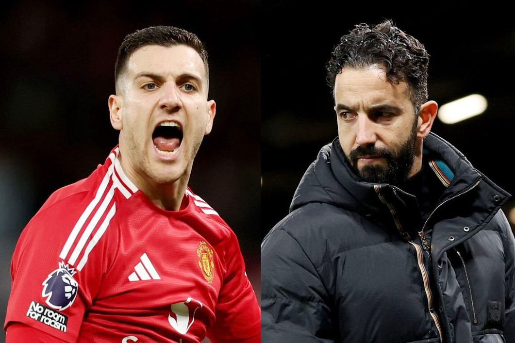 MU nhận thêm tin dữ, phản ứng của Ruben Amorim