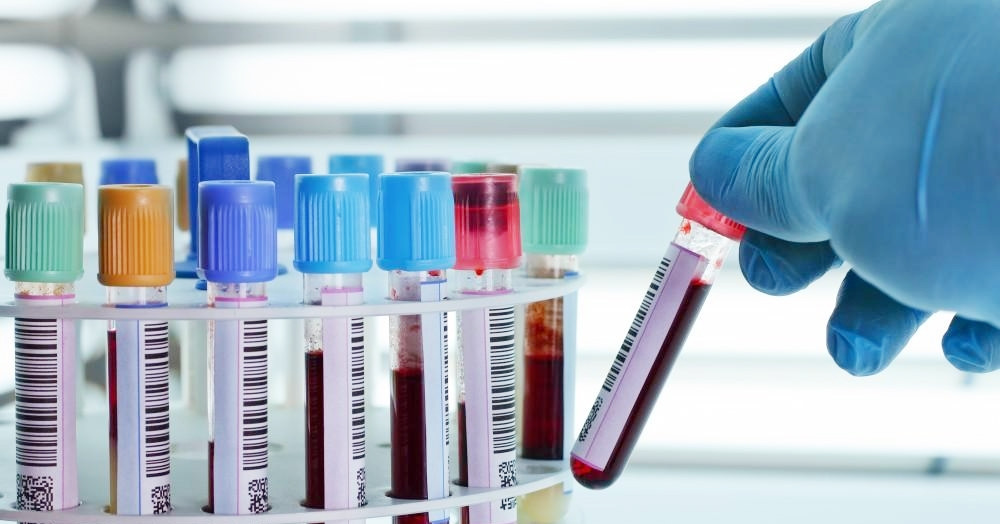 Bộ Y tế thông tin về dịch bệnh bí ẩn tại Liên bang Nga