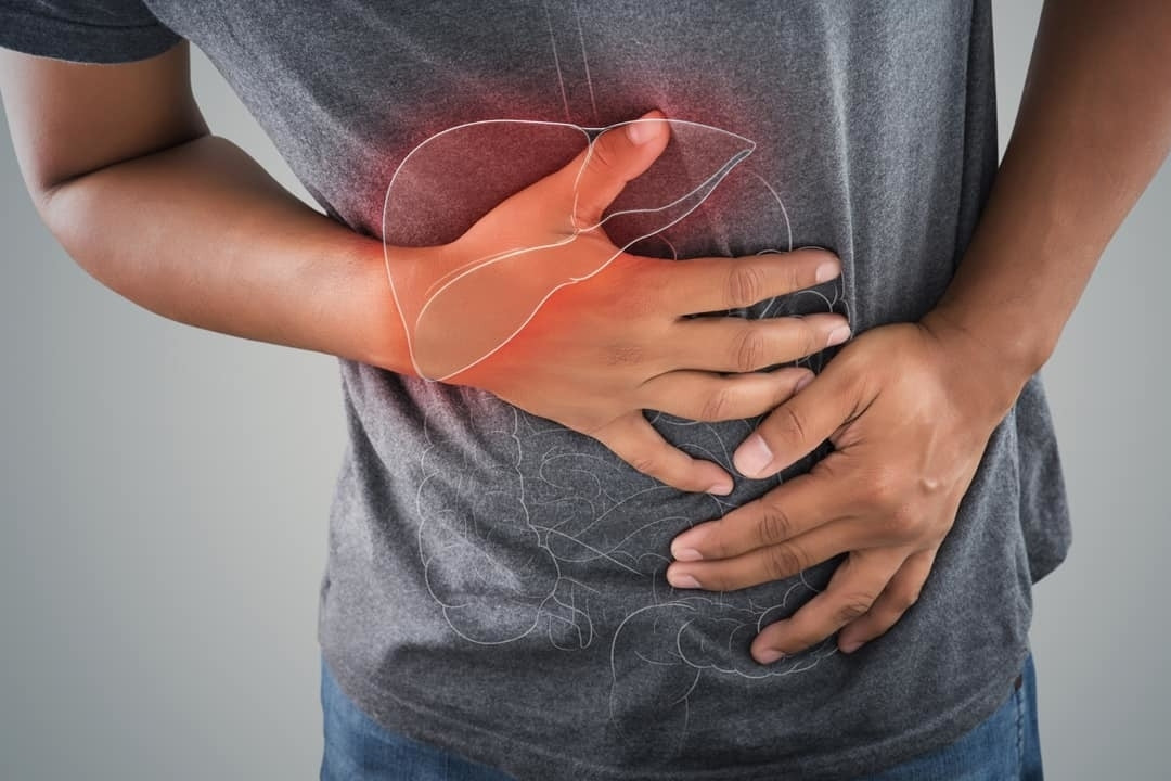 Bỏ qua 2 triệu chứng không đau, người đàn ông phát hiện ung thư khi đã muộn