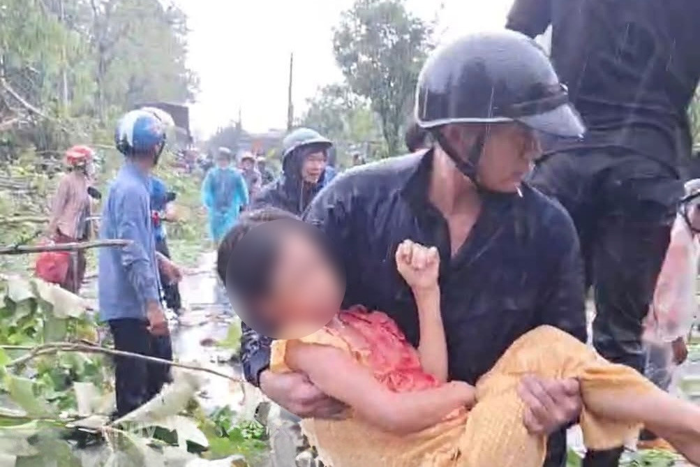 Mưa giông quật đổ nhiều cây lớn, 1 phụ nữ phải cấp cứu