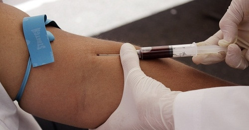 Nam thanh niên máu đục như sữa, bác sĩ cảnh báo nóng