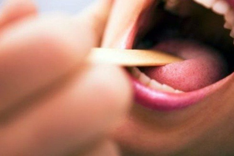 Phát hiện loại ung thư nguy hiểm từ vết lạ trên lưỡi