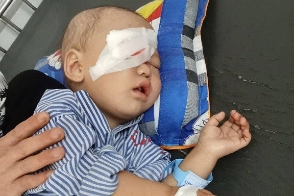 Con trai bị ung thư võng mạc, cha mẹ nghèo bán cả đàn lợn không đủ tiền cứu con