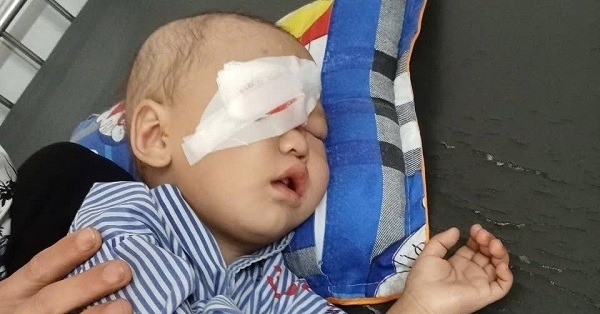 Con trai bị ung thư võng mạc, cha mẹ nghèo bán cả đàn lợn không đủ tiền cứu con