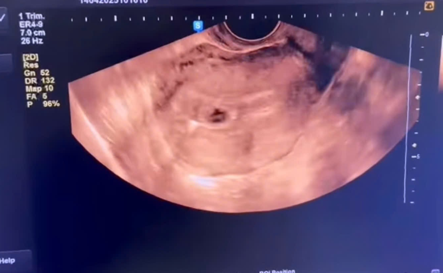 image 20250501141014 1 2.png