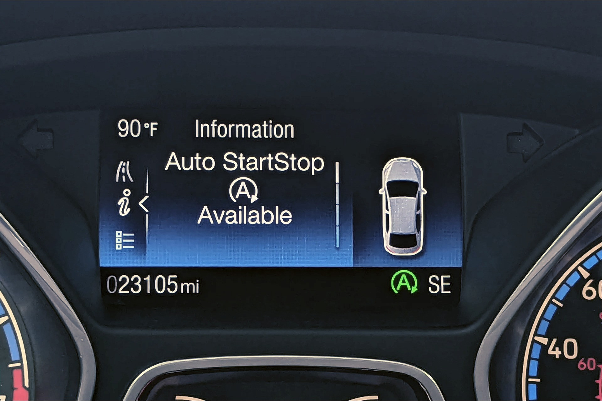 auto start stop.jpeg