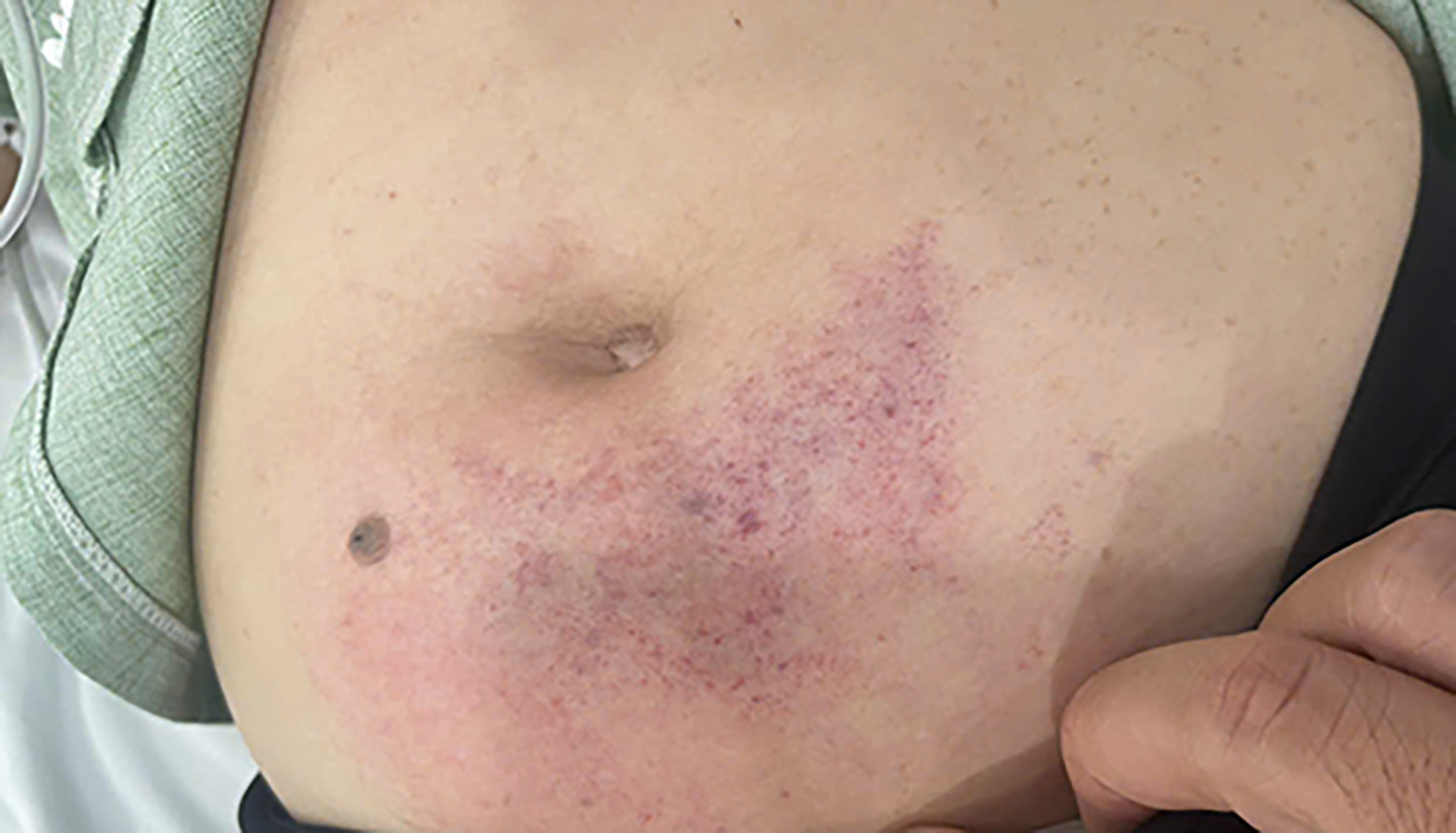 đánh GV Phú Quốc.jpg