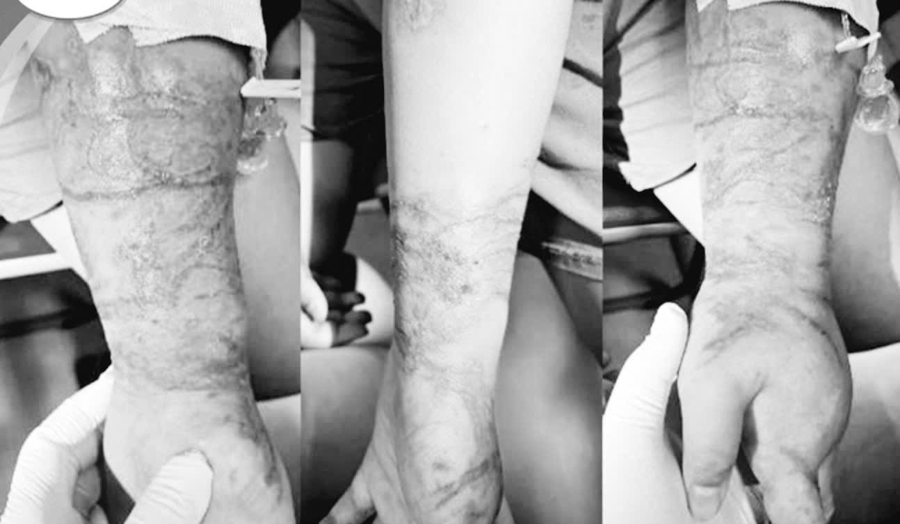 ton thuong sua dot.jpg