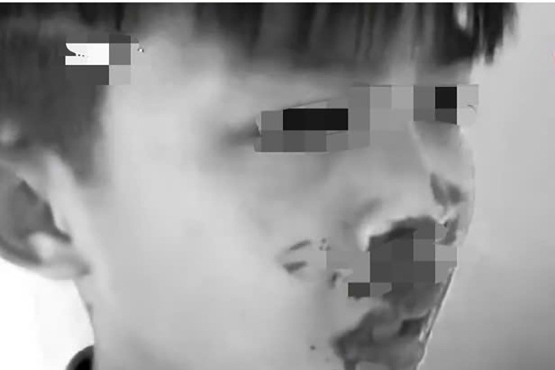 Hai học sinh trêu nhau, phụ huynh đánh nam sinh lớp 7 nhập viện