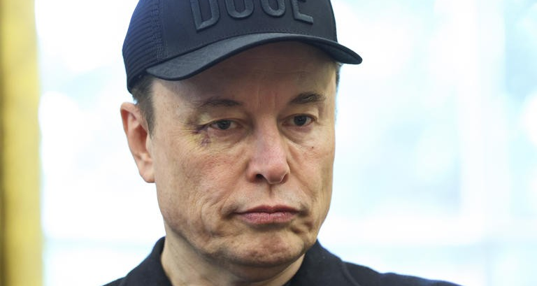 Elon Musk đến Nhà Trắng với một bên mắt tím bầm, ai là thủ phạm?