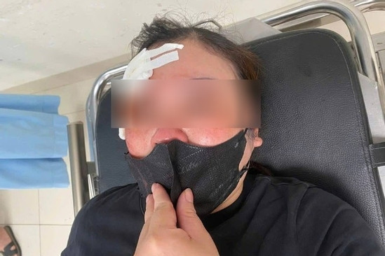 Bản tin chiều 7/5: Nữ tài xế Hà Nội tố bị người đi ô tô dùng dùi cui vụt vào đầu