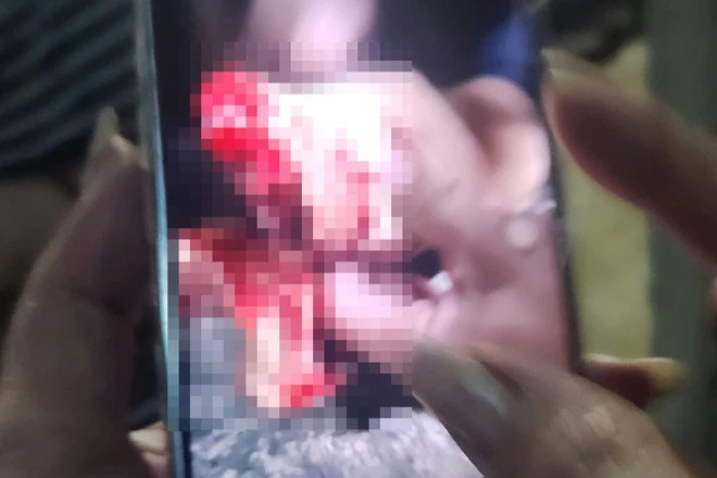 Bản tin trưa 7/5: Truy bắt nhóm thanh niên chém đứt lìa bàn tay người đàn ông