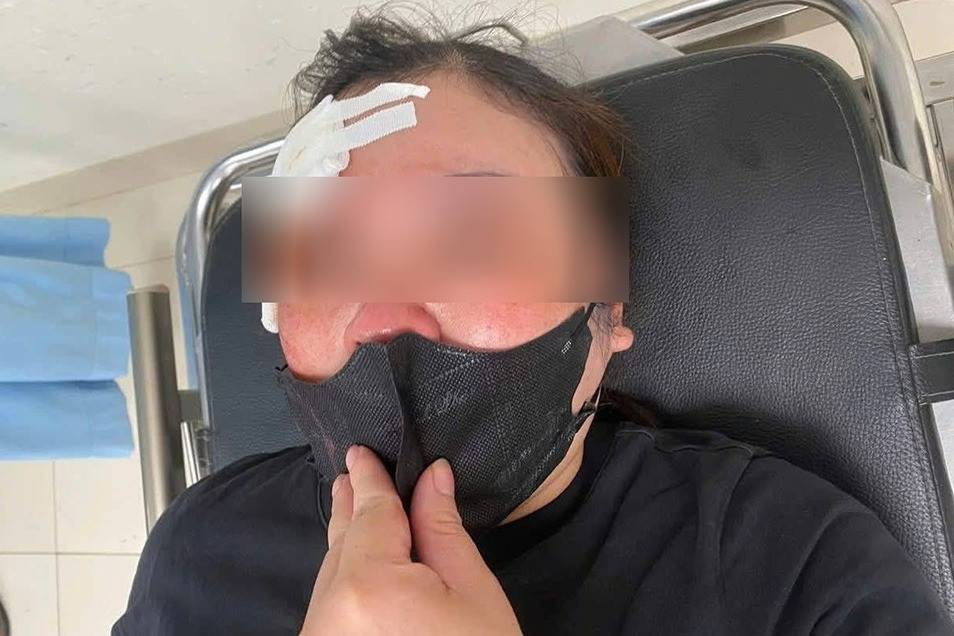 Bộ Công an khuyên người dân kiềm chế, mang 'cái đầu lạnh’ khi đi đường