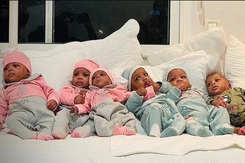 Cuộc sống của những đứa trẻ từng gây chấn động thế giới trong ca sinh 9 hiếm gặp