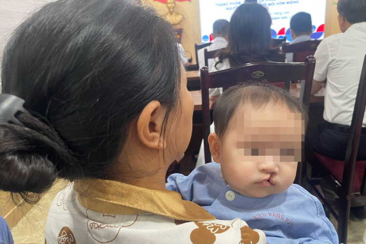 Sửa dị tật hở hàm ếch miễn phí cho trẻ