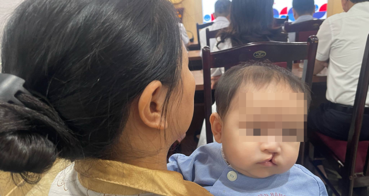 Sửa dị tật hở hàm ếch miễn phí cho trẻ