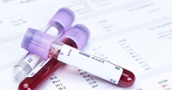 6 biểu hiện cảnh báo bệnh máu cần đi khám ngay