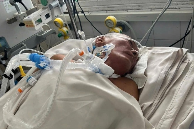 Giẫm phải gai nhọn, người đàn ông bị nhiễm trùng uốn ván, tính mạng nguy kịch