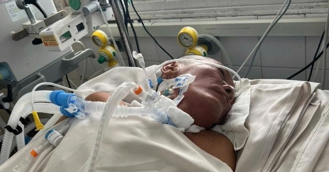 Giẫm phải gai nhọn, người đàn ông bị nhiễm trùng uốn ván, tính mạng nguy kịch