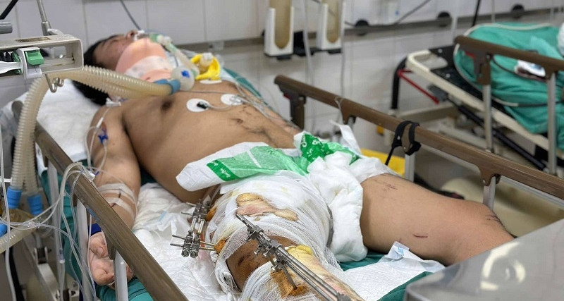 Con bị tai nạn nguy kịch, bố mẹ nghèo bán xe máy lấy 5 triệu đồng cứu con