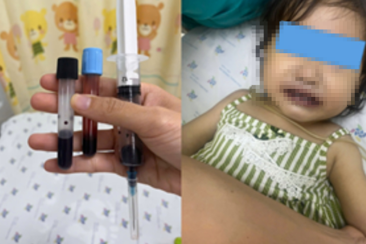 Máu của bé gái chuyển màu nâu đen sau khi ăn canh nấu bằng nước giếng