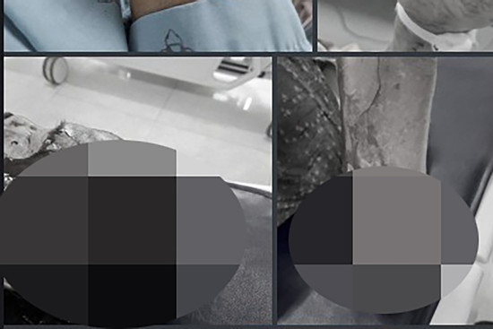 Bản tin cuối ngày 25/6: Người phụ nữ U60 chém nhau với tình địch đến nguy kịch