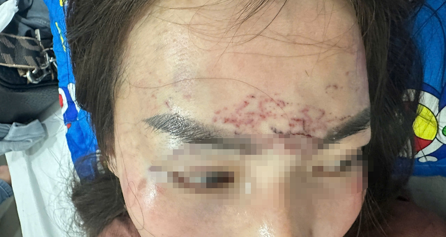Khởi tố hai người phụ nữ vụ 'tra tấn' bằng axit và máy xăm
