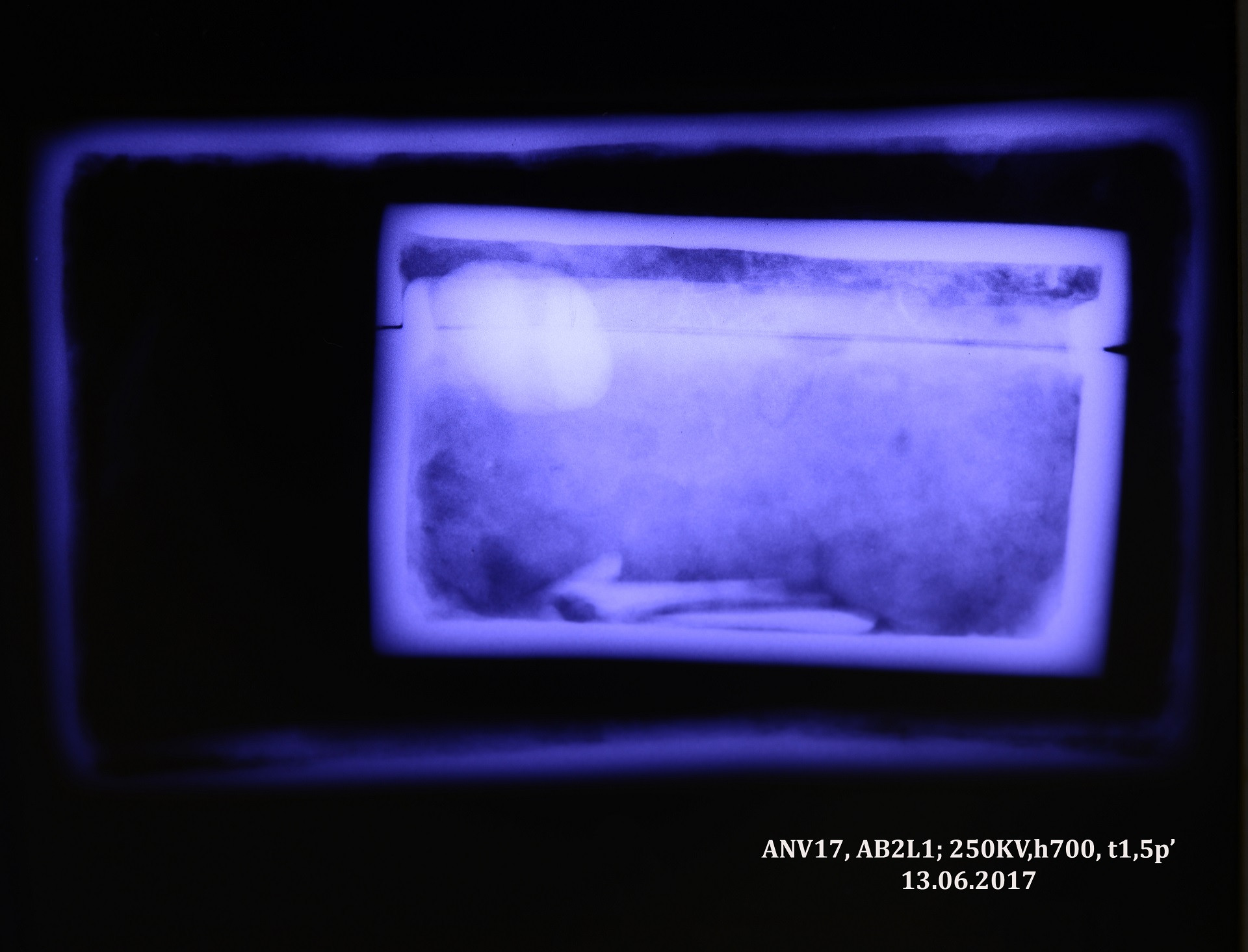 Anh 10 Chup x quang 1.jpg