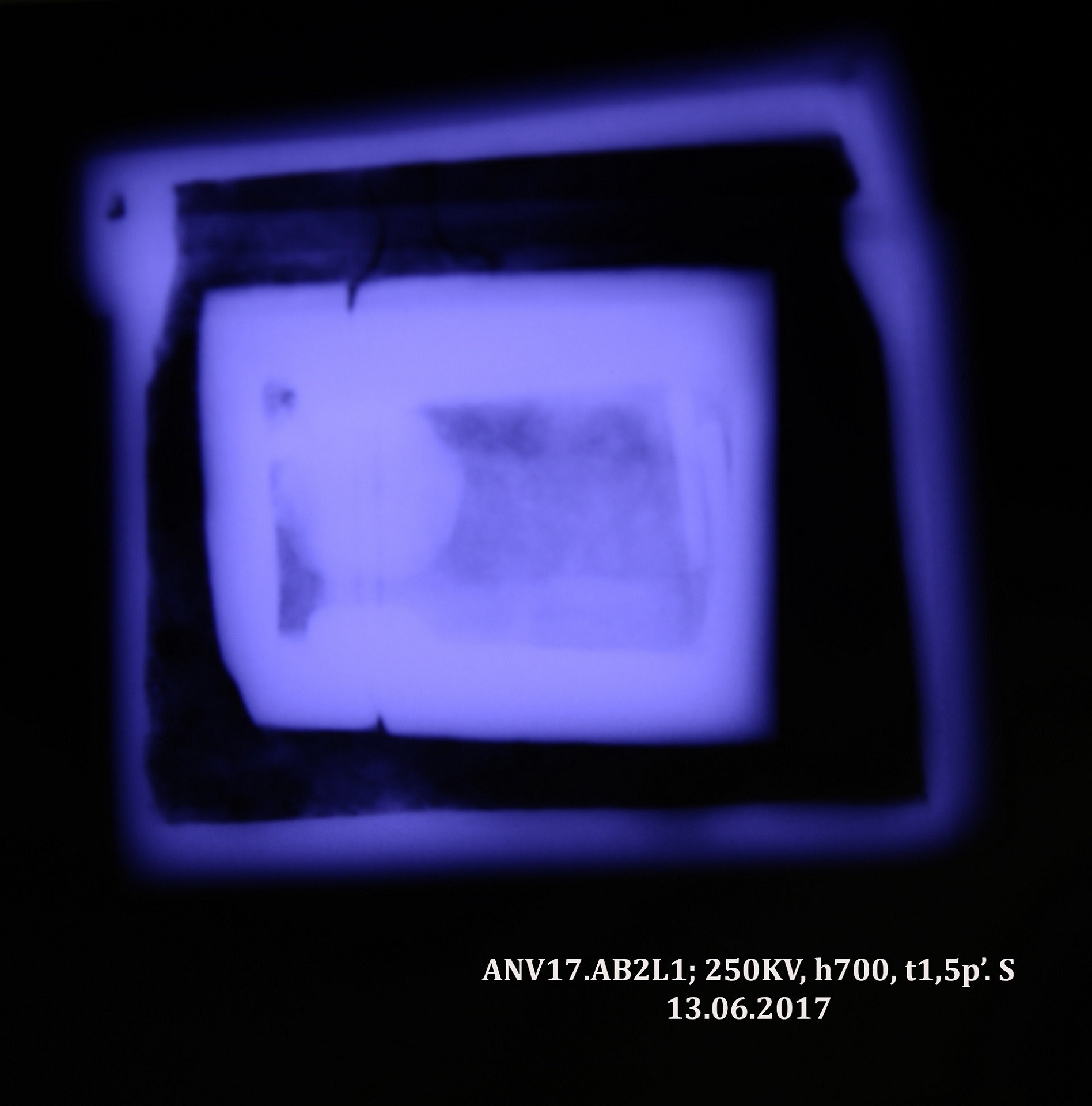 Anh 10 Chup x quang .jpg