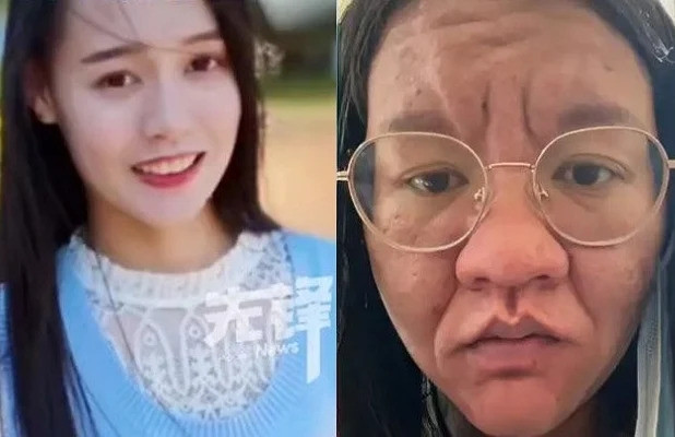 Cô gái gây sốc vì gương mặt thay đổi không nhận ra khi mang thai