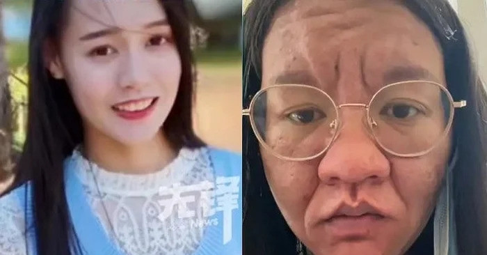 Cô gái gây sốc vì gương mặt thay đổi không nhận ra khi mang thai