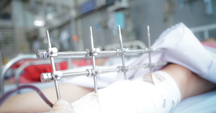 Căn Nhà Sập Do Mưa Lớn: Nạn Nhân Bị Thương Nghiêm Trọng Được Cấp Cứu Khẩn Cấp Tại TP.HCM