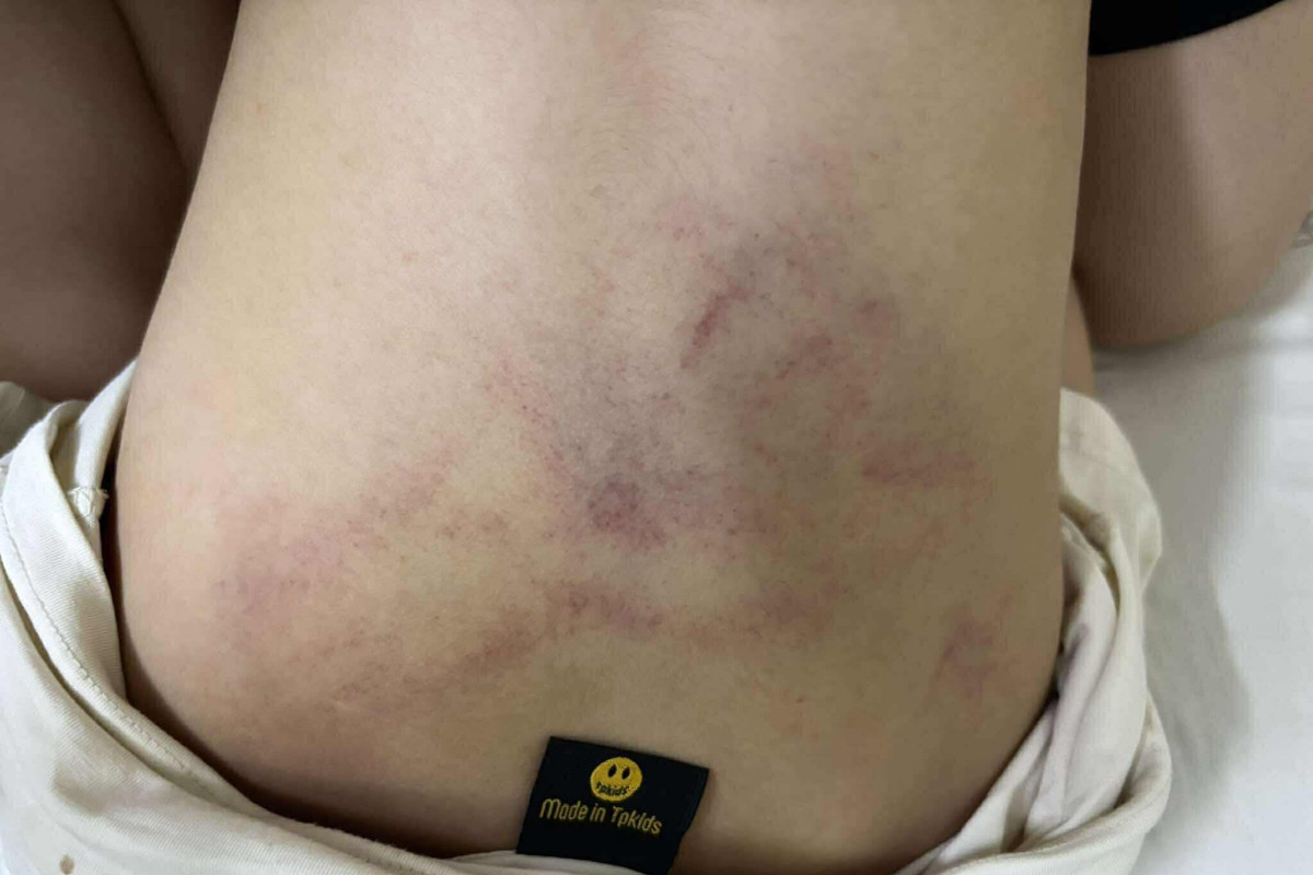 Bé gái bị đánh, kéo lê ở trường mầm non Hà Nội: Tạm đình chỉ giáo viên chứng kiến nhưng mặc kệ